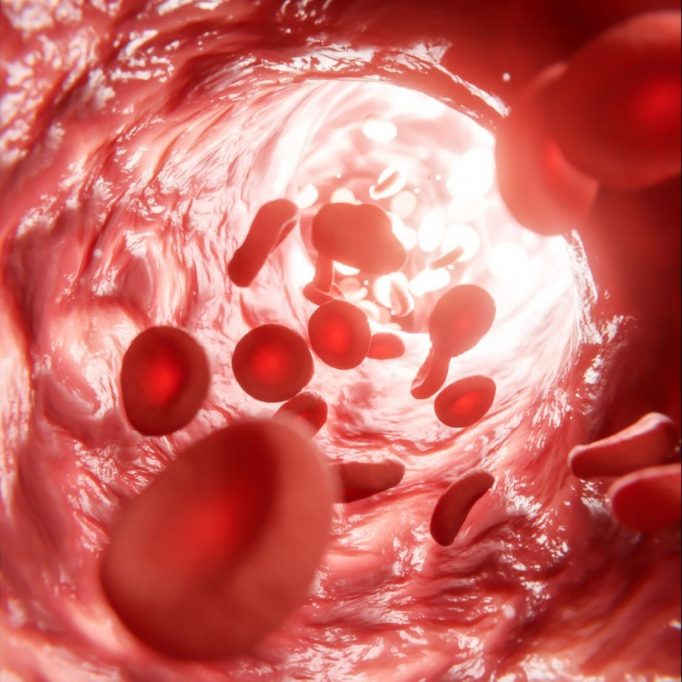 Ultraviolet Blood Irradiation 1